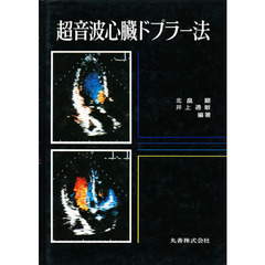 超音波心臓ドプラー法