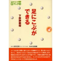 足にこぶができる　下肢静脈瘤