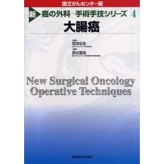 新癌の外科－手術手技シリーズ　４　大腸癌