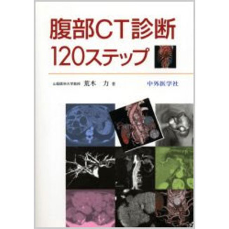 腹部CT診断120ステップ 改訂2版 通販｜セブンネット