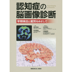 認知症の脳画像診断　早期検出と鑑別をめざして