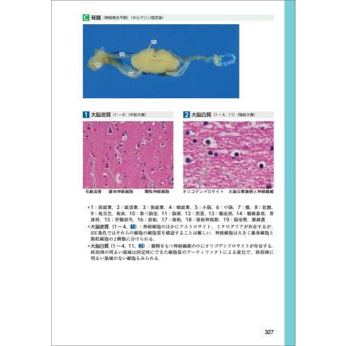 正常画像と比べてわかる病理アトラス マクロとミクロの対応で捉える