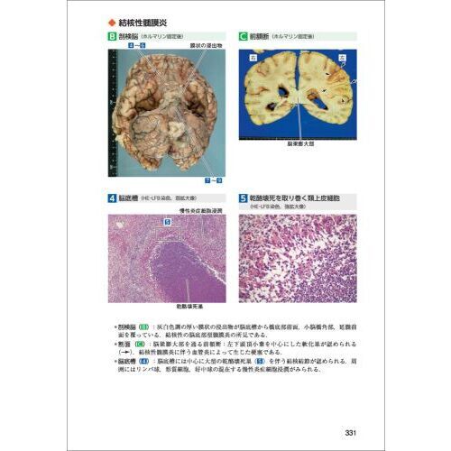 正常画像と比べてわかる病理アトラス マクロとミクロの対応で捉える