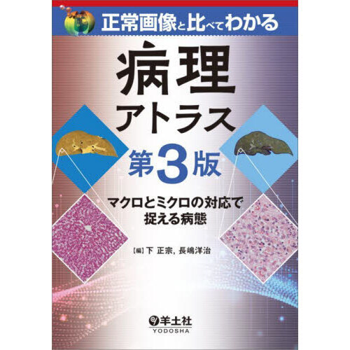 正常画像と比べてわかる病理アトラス　マクロとミクロの対応で捉える病態　第３版