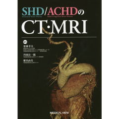 ＳＨＤ／ＡＣＨＤのＣＴ・ＭＲＩ