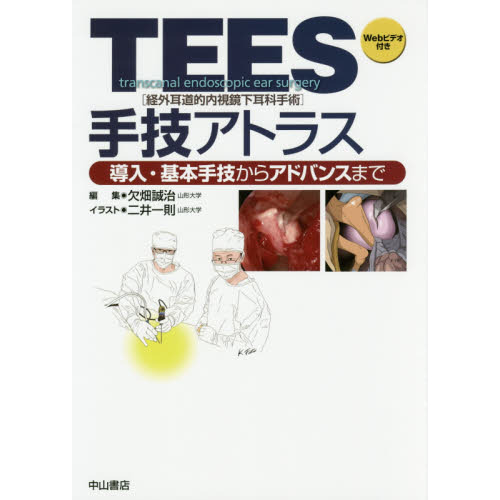 ＴＥＥＳ〈経外耳道的内視鏡下耳科手術〉手技アトラス 導入・基本手技