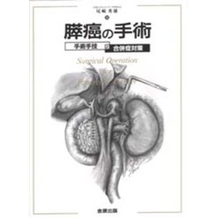 膵癌の手術　手術手技と合併症対策
