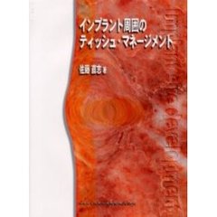 インプラント周囲のティッシュ・マネージメント