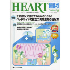 ハートナーシング　ベストなハートケアをめざす心臓疾患領域の専門看護誌　第２０巻５号（２００７－５）　特集正常波形との比較でみるみるわかる！ベッドサイドで役立つ異常波形の読み方