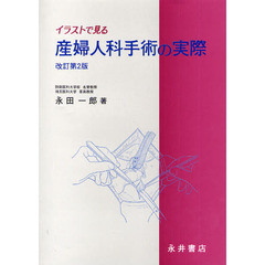 イラストで見る産婦人科手術の実際　改訂第２版