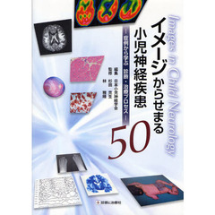 イメージからせまる小児神経疾患５０　症例から学ぶ診断・治療プロセス