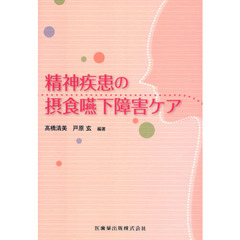 精神疾患の摂食嚥下障害ケア