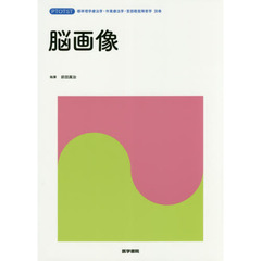 脳画像