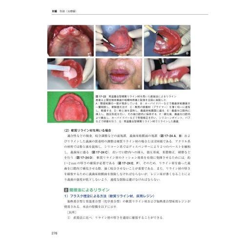 無歯顎補綴治療学　第４版