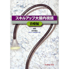 スキルアップ大腸内視鏡　治療編