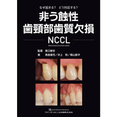 非う蝕性歯頸部歯質欠損ＮＣＣＬ　なぜ起きる？どう対応する？