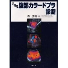できる腹部カラードプラ診断