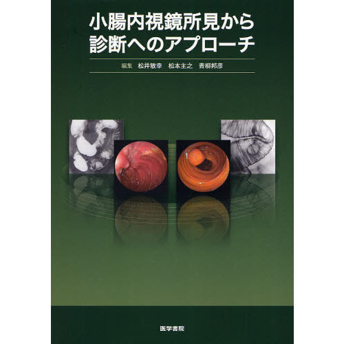 小腸内視鏡所見から診断へのアプローチ