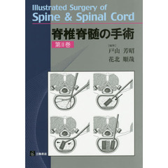脊椎脊髄の手術　第２巻