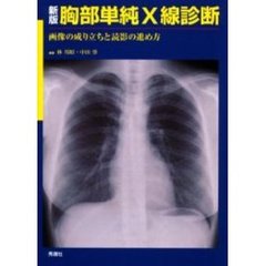 胸部単純Ｘ線診断　画像の成り立ちと読影の進め方　新版