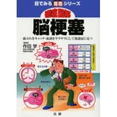 徹底図解脳梗塞　前ぶれをキャッチ・血液をサラサラにして後遺症に克つ
