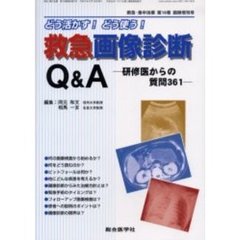 救急画像診断Ｑ＆Ａ　どう活かす！どう使う！　研修医からの質問３６１