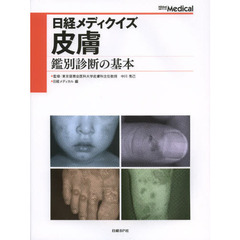 皮膚　鑑別診断の基本