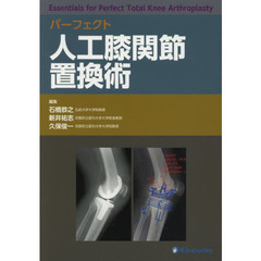 パーフェクト人工膝関節置換術