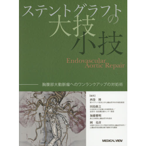 ステントグラフトの大技・小技 胸腹部大動脈瘤へのワンランクアップの