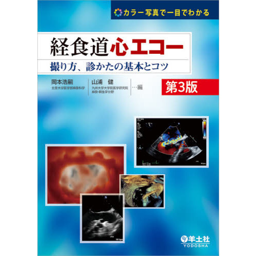 経食道心エコー カラー写真で一目でわかる 撮り方、診かたの基本とコツ 