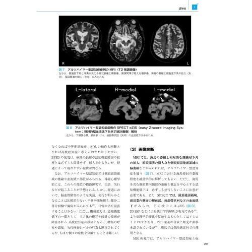 高次脳機能障害学　第３版