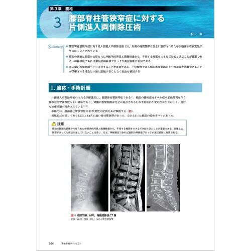 ロピア 爆買い 脊椎手術パーフェクト 術前準備から展開、除圧、固定、閉創まで 健康・医学