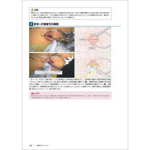 【裁断済】脊椎手術パーフェクト SPINE 脊椎手術パーフェクト 術前準備から展開、除圧、固定、閉創まで