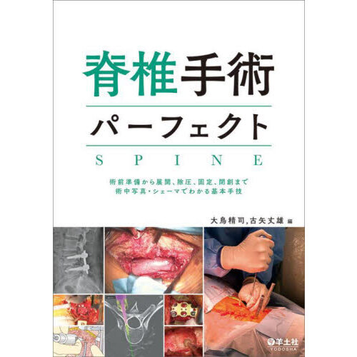 脊椎手術パーフェクト SPINE 脊椎手術パーフェクト〜術前準備から展開、除圧、固定、閉創まで