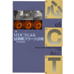 心ＣＴ　０５　〈特集〉ＭＤＣＴによる冠動脈プラーク診断