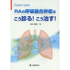 ＲＡの呼吸器合併症はこう診る！こう治す！　Ｅｘｐｅｒｔ　ｅｙｅｓ