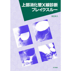 上部消化管Ｘ線診断ブレイクスルー