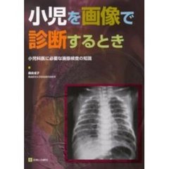 小児を画像で診断するとき　小児科医に必要な画像検査の知識