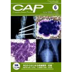 ＣＡＰ　２０４