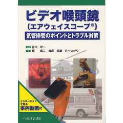 ビデオ喉頭鏡〈エアウェイスコープ〉　気管挿管のポイントとトラブル対策