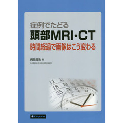 症例でたどる頭部ＭＲＩ・ＣＴ　時間経過で画像はこう変わる