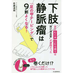 下肢静脈瘤は「足の甲テーピング」で９割よくなる！　足のむくみ・こむら返りは“抜け道血管”が原因だった