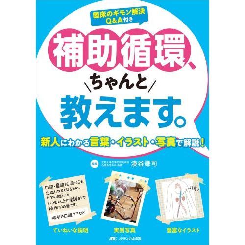 補助循環、ちゃんと教えます。　新人にわかる言葉・イラスト・写真で解説！　臨床のギモン解決Ｑ＆Ａ付き