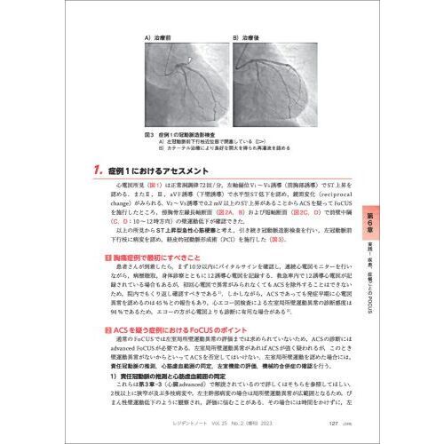 まず当ててみようＰＯＣＵＳ　各臓器のエコー描出・評価のポイントを押さえショック、呼吸困難、腹痛などさまざまな症状・症候にも対応できる