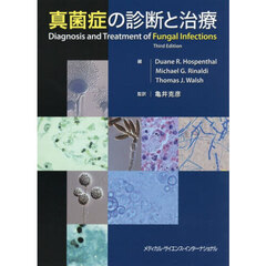真菌症の診断と治療