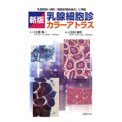乳腺細胞診カラーアトラス　新版