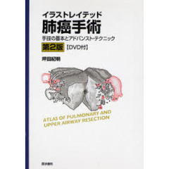 イラストレイテッド肺癌手術　手技の基本とアドバンスト・テクニック　第２版