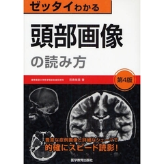 ゼッタイわかる頭部画像の読み方　第４版
