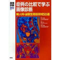 症例の比較で学ぶ画像診断　婦人科・泌尿生殖器領域５０選