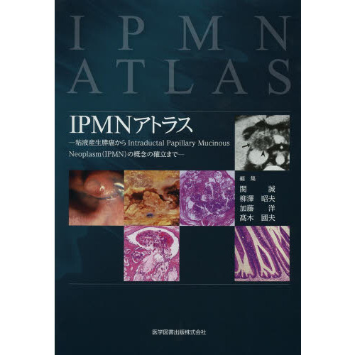 IPMNアトラス ─粘液産生膵癌からIntraductal Papillary Mucinous Neoplasm(IPMN)の概念の確立まで 関   誠 柳澤 昭夫 加藤  洋; ?木 國夫 IPMNアトラス 粘液産生膵癌からIntraductal